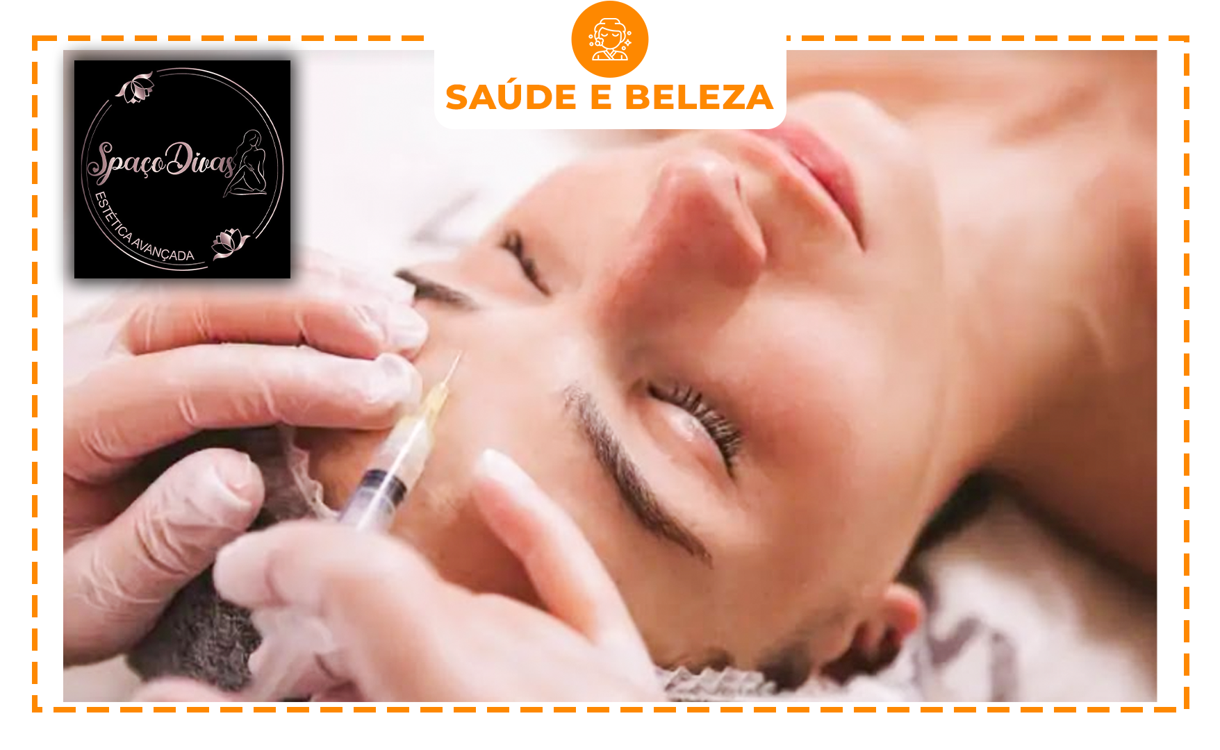 01 APLICAÇÃO DE BOTOX (ROSTO) + PREENCHIMENTO